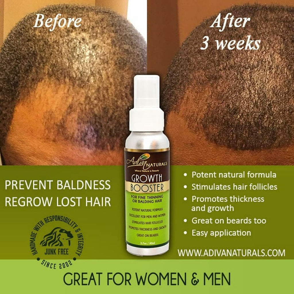 Hair Growth Booster (For Thinning or Balding Hair) Adiva Naturals